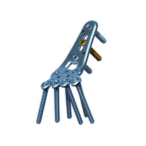 Medartis TriLock distal radius fixation plate