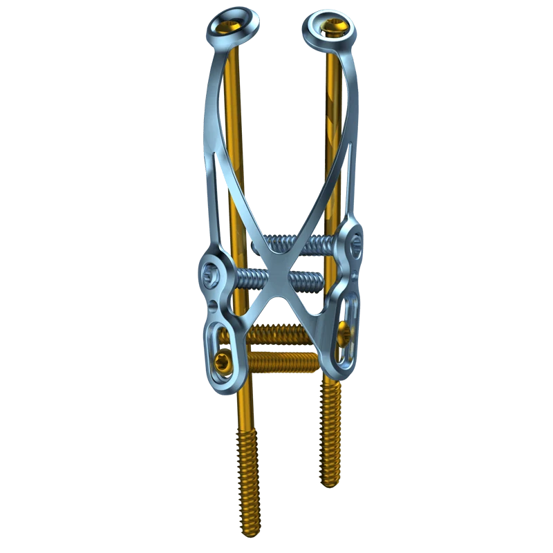 2.8 TriLock Olecranon Tension Plate